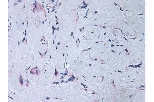 Image no. 2 for anti-Platelet Factor 4 (PF4) antibody (ABIN465152) (PF4 antibody)