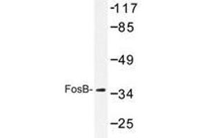Western blot analyzes of FosB antibody in extracts from COS7 cells. (FOSB antibody)
