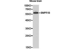 Western Blotting (WB) image for anti-Bone Morphogenetic Protein Receptor, Type IB (BMPR1B) antibody (ABIN1871327) (BMPR1B antibody)