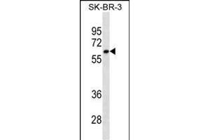 CYP1A2 Antibody ABIN1539921 western blot analysis in SK-BR-3 cell line lysates (35 μg/lane). (CYP1A2 antibody  (AA 255-282))