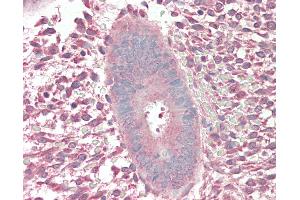Human Uterus: Formalin-Fixed, Paraffin-Embedded (FFPE). (AMHR2 antibody  (N-Term))
