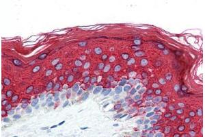 Human Skin (formalin-fixed, paraffin-embedded) stained with KRT10 antibody ABIN364279 at 10 ug/ml followed by biotinylated anti-mouse IgG secondary antibody ABIN481714, alkaline phosphatase-streptavidin and chromogen. (Keratin 10 antibody)