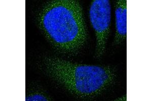 Immunofluorescent staining of U-2 OS with UBE2I polyclonal antibody  (Green) shows positivity in cytoplasm. (UBE2I antibody)