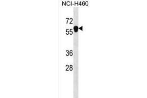ANKDD1B Antibody (C-term) (ABIN1537327 and ABIN2850198) western blot analysis in NCI- cell line lysates (35 μg/lane). (ANKDD1B antibody  (C-Term))