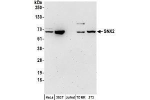 anti-Sorting Nexin 2 (SNX2) (AA 1-50) antibody