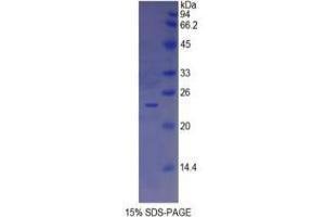 SDS-PAGE analysis of Human Insulin Like Growth Factor Binding Protein 6 (IGFBP6) Protein. (IGFBP6 Protein)