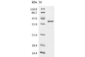 Free Fatty Acid Receptor 2 (FFAR2) (AA 277-330) protein (His-GST)
