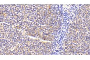 Immunohistochemistry (IHC) image for anti-Tumor Necrosis Factor Receptor Superfamily, Member 11a, NFKB Activator (TNFRSF11A) (AA 330-615) antibody (ABIN7434629)