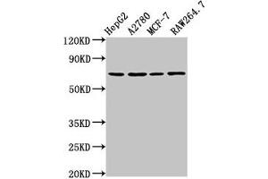 Western Blot Positive WB detected in: HepG2 whole cell lysate, A2780 whole cell lysate, MCF-7 whole cell lysate, RAW264.