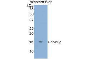 Detection of Recombinant CEA, Human using Polyclonal Antibody to Carcinoembryonic Antigen (CEA) (CEA antibody  (AA 566-698))