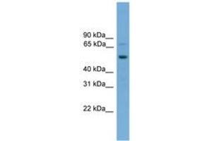 Image no. 1 for anti-SKI-Like Oncogene (SKIL) (AA 539-588) antibody (ABIN6745607) (SKIL antibody  (AA 539-588))