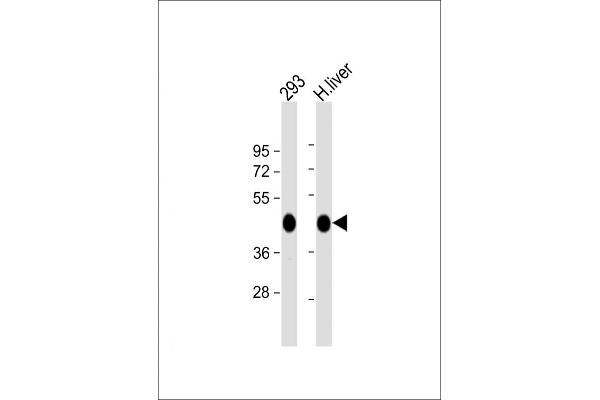 OAT antibody  (N-Term)