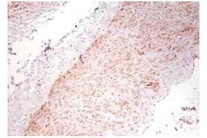 Immunohistochemistry using  polyclonal TNFa antibody showing staining of formalin/PFA-fixed paraffin-embedded sections of human artery tissue sections. (TNF alpha antibody)