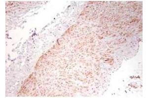 Immunohistochemistry (IHC) image for anti-Tumor Necrosis Factor alpha (TNF alpha) antibody (ABIN5596796)