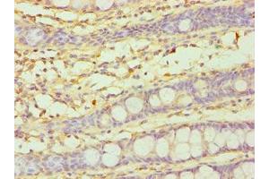 Immunohistochemistry of paraffin-embedded human colon tissue using ABIN7149265 at dilution of 1:100 (CYP3A5 antibody  (AA 233-502))