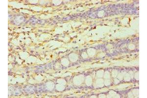Immunohistochemistry of paraffin-embedded human colon tissue using ABIN7149265 at dilution of 1:100 (CYP3A5 antibody  (AA 233-502))