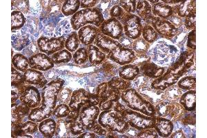 IHC-P Image GDI1 antibody detects GDI1 protein at cytosol on mouse kidney by immunohistochemical analysis. (GDI1 antibody)