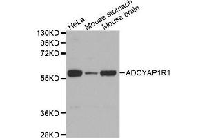 Western Blotting (WB) image for anti-Adenylate Cyclase Activating Polypeptide 1 (Pituitary) Receptor Type I (ADCYAP1R1) antibody (ABIN6220077) (ADCYAP1R1 antibody)