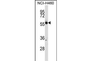 CR Antibody (N-term) (ABIN657682 and ABIN2846674) western blot analysis in NCI- cell line lysates (35 μg/lane). (CRMP1 antibody  (N-Term))