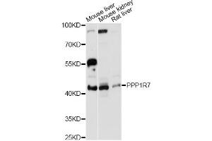 Western blot analysis of extracts of various cell lines, using PPP1R7 antibody (ABIN6293696) at 1:3000 dilution. (PPP1R7 antibody)