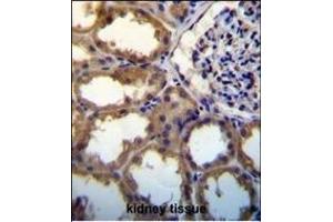 PDGFC antibody (N-term) (ABIN650654 and ABIN2837869) immunohistochemistry analysis in formalin fixed and paraffin embedded human kidney tissue followed by peroxidase conjugation of the secondary antibody and DAB staining. (PDGFC antibody  (N-Term))