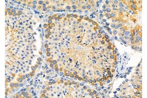 ABIN6264206 and ABIN6279656 at 1/100 staining Mouse testis tissue by IHC-P. (PIGP antibody  (Internal Region))