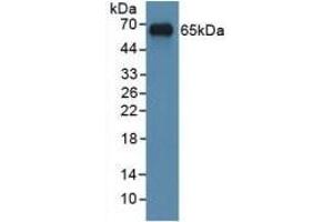 Detection of Recombinant MYC, Human using Polyclonal Antibody to V-Myc Myelocytomatosis Viral Oncogene Homolog (MYC) (LMYC antibody  (AA 184-454))