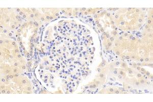 Detection of LAMa3 in Human Kidney Tissue using Monoclonal Antibody to Laminin Alpha 3 (LAMa3) (LAMA3 antibody  (AA 47-296))