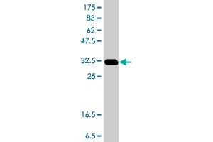 Western Blot detection against Immunogen (37. (KPNA3 antibody  (AA 422-521))