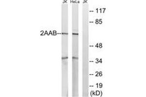 Western blot analysis of extracts from HeLa/Jurkat cells, using PPP2R1B Antibody. (PPP2R1B antibody  (AA 552-601))