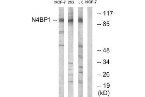 Western blot analysis of extracts from MCF-7 cells, 293 cells and Jurkat cells, using N4BP1 antibody. (N4BP1 antibody  (Internal Region))
