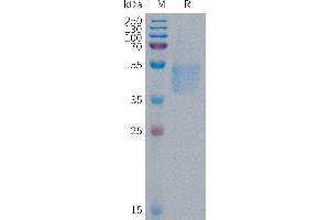 Follistatin-Like 1 (FSTL1) (AA 21-308) protein (His tag)