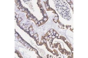 Immunohistochemical staining of human duodenum with FAM109B polyclonal antibody  shows moderate cytoplasmic and membranous positivity in glandular cells. (FAM109B antibody)