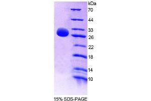 Image no. 1 for Inhibitor of kappa Light Polypeptide Gene Enhancer in B-Cells, Kinase beta (IKBKB) (AA 1-231) protein (His tag) (ABIN6237274) (IKBKB Protein (AA 1-231) (His tag))
