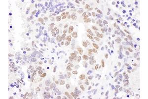 Immunohistochemistry (IHC) image for anti-Hexamethylene Bis-Acetamide Inducible 1 (HEXIM1) (AA 309-359) antibody (ABIN7454896)