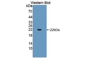 Western blot analysis of the recombinant protein. (SLIT3 antibody  (AA 1405-1512))