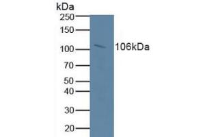 Detection of RB1 in Human Serum using Polyclonal Antibody to Retinoblastoma Protein 1 (RB1) (Retinoblastoma 1 antibody  (AA 639-778))