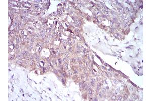 Immunohistochemistry (IHC) image for anti-Polycystic Kidney and Hepatic Disease 1 Protein (PKHD1) (AA 3878-4060) antibody (ABIN5542352)