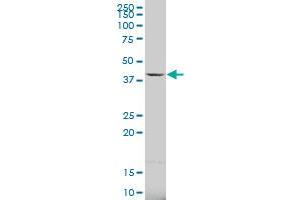 CA5B polyclonal antibody (A01), Lot # 051213JC01 Western Blot analysis of CA5B expression in Jurkat . (CA5B antibody  (AA 2-90))