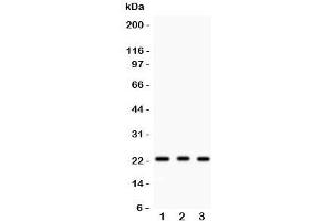 Western blot testing of MGMT antibody and human samples 1:  HeLa;  2: placenta;  3: Jurkat. (MGMT antibody  (AA 2-207))