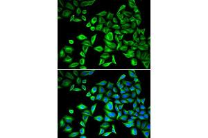 Immunofluorescence (IF) image for anti-C-Reactive Protein (CRP) (AA 1-224) antibody (ABIN3020716) (CRP antibody  (AA 1-224))