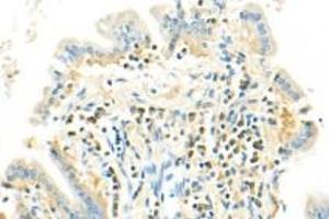Immunohistochemistry analysis of paraffin-embedded mouse colon using SLK (ABIN7075729) at dilution of 1: 500