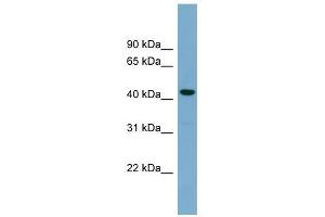 CDCA7L antibody used at 1 ug/ml to detect target protein.