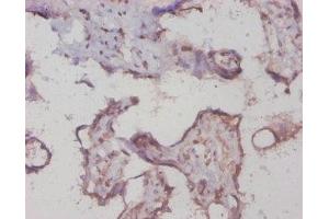 Immunohistochemistry of paraffin-embedded human placenta tissue using ABIN7154210 at dilution of 1:20 (PYGL antibody  (AA 2-846))