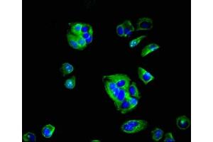 Immunofluorescent analysis of MCF-7 cells using ABIN7157166 at dilution of 1:100 and Alexa Fluor 488-congugated AffiniPure Goat Anti-Rabbit IgG(H+L) (F11R antibody  (AA 31-224))
