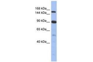 Image no. 1 for anti-Nuclear Receptor Coactivator 2 (NCOA2) (N-Term) antibody (ABIN6742809)