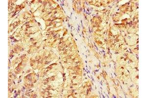Immunohistochemistry of paraffin-embedded human adrenal gland tissue using ABIN7144308 at dilution of 1:100 (Anoctamin 4 antibody  (AA 1-200))