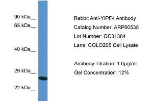 Western Blotting (WB) image for anti-Yip1 Domain Family, Member 4 (YIPF4) (N-Term) antibody (ABIN2788486) (YIPF4 antibody  (N-Term))