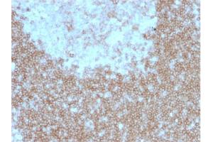 Formalin-fixed, paraffin-embedded human Tonsil stained with CD268 / BAFFR Mouse Monoclonal Antibody (BAFFR/1557).