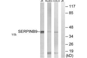 Western blot analysis of extracts from Jurkat cells, using SERPINB9 antibody. (SERPINB9 antibody  (Internal Region))